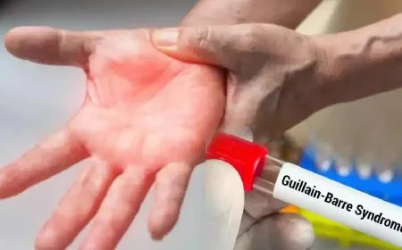 28 people on ventilator in Maharashtra as Guillain-Barre Syndrome cases increase to 149, death toll at 5